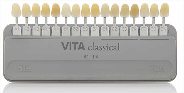 The VITA classical A1 – D4 shade guide